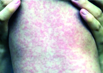 IMSS alcanza cifra récord de 22.8 millones de empleos registrados