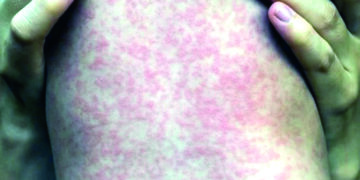 IMSS alcanza cifra récord de 22.8 millones de empleos registrados