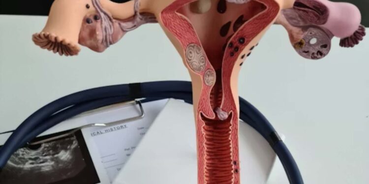 Asociación mexicana pide priorizar la atención del cáncer de ovario