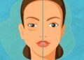 SESA alerta sobre síntomas del angioedema hereditario