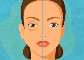 SESA alerta sobre síntomas del angioedema hereditario