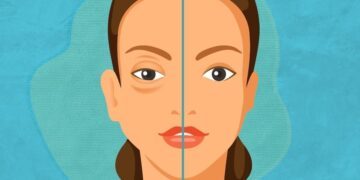 SESA alerta sobre síntomas del angioedema hereditario