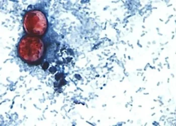 Alerta RU casos de ciclosporiasis ligados a viajes a México