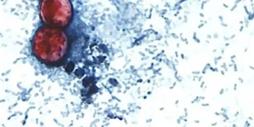 Alerta RU casos de ciclosporiasis ligados a viajes a México