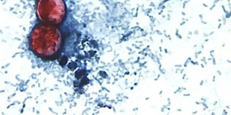 Alerta RU casos de ciclosporiasis ligados a viajes a México