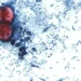 Alerta RU casos de ciclosporiasis ligados a viajes a México